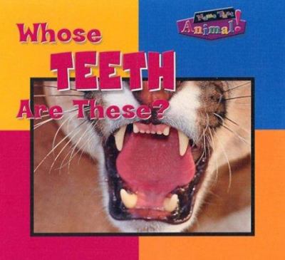 Whose teeth are these?  cover image cdn