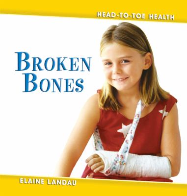 Broken bones  cover image cdn