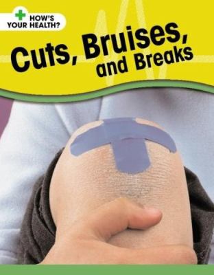 Cuts, bruises, and breaks  cover image cdn