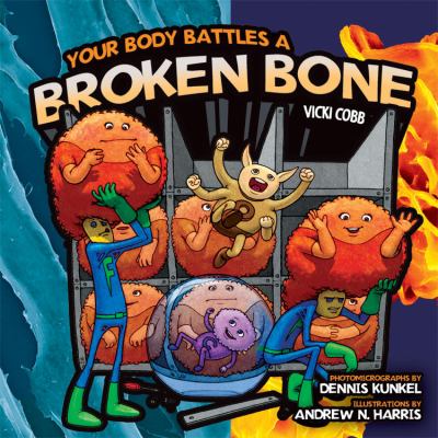 Your body battles a broken bone  cover image cdn