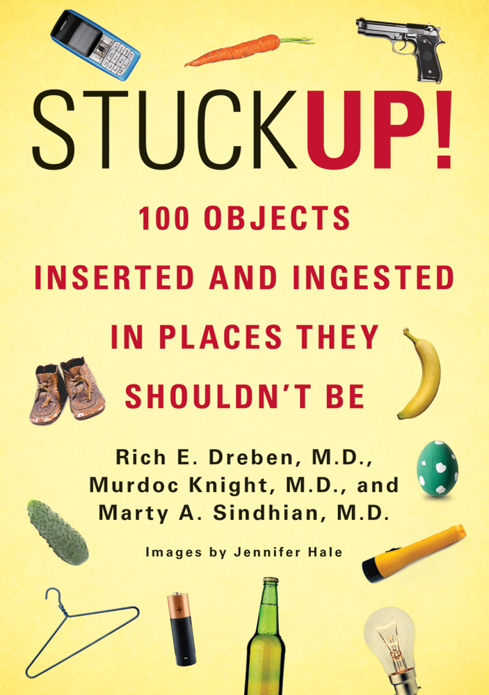 Stuck up! : 100 objects inserted and ingested in places they shouldn't be  cover image cdn