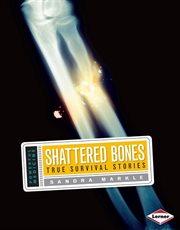 Shattered bones: true survival stories cover image cdn