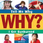 I get sunburned cover image cdn