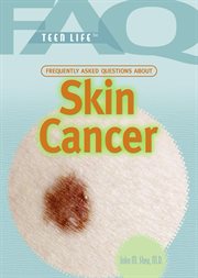 Frequently asked questions about skin cancer cover image cdn