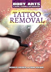 Tattoo removal cover image cdn