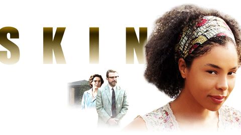 Skin cover image cdn