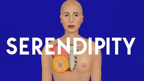 Serendipity cover image cdn