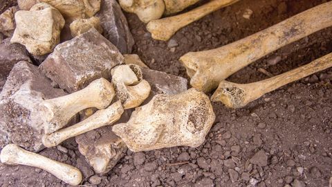 Food, Science, and the Human Body. Episode 3, Stones, Bones, and Teeth cover image cdn