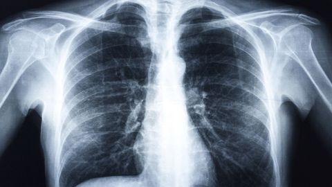 Medical School for Everyone: Grand Rounds Cases. Episode 11, I Can't Walk cover image cdn