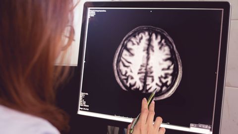 What Darwin Didn't Know. Episode 19, The Evolution of Brains and Behavior cover image cdn