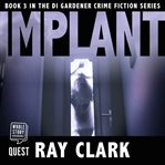 Implant cover image cdn
