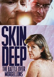 Skin deep. The Battle Over Morgellons cover image cdn