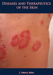 Diseases and therapeutics of the skin cover image cdn