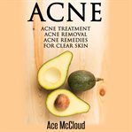 Acne: acne treatment: acne removal: acne remedies for clear skin cover image cdn