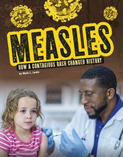 Measles : how a contagious rash changed history cover image cdn