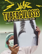 Tuberculosis : how the white death changed history cover image cdn