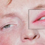 Dandelion cover image cdn