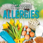What you need to know about allergies cover image cdn