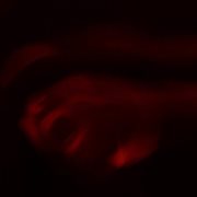 One lumen cover image cdn