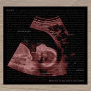 Too asleep to hear the massive wind blow cover image cdn