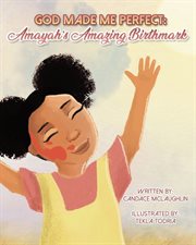 God made me perfect amayahs's amazing birthdmark cover image cdn