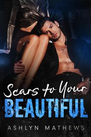 Scars to your beautiful cover image cdn