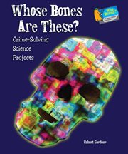 Whose bones are these? : Crime-Solving Science Projects cover image cdn