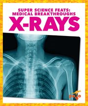 X-Rays cover image cdn