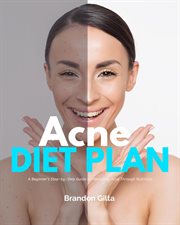 Acne Diet Plan : A Beginner's Step-by-Step Guide to Managing Acne Through Nutrition With Curated Recipes and a Sample cover image cdn
