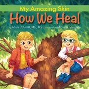 How We Heal : My Amazing Skin cover image cdn