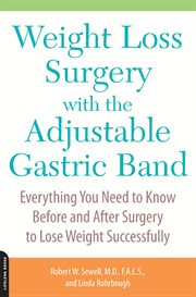 Weight Loss Surgery With the Adjustable Gastric Band : Everything You Need to Know Before and After Surgery to Lose Weight Successfully cover image cdn