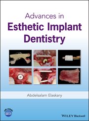 Advances in Esthetic Implant Dentistry cover image cdn