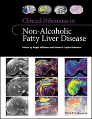 Clinical Dilemmas in Non-Alcoholic Fatty Liver Disease cover image cdn