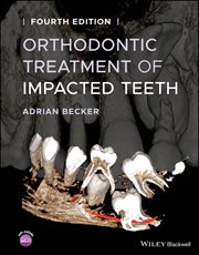 Orthodontic Treatment of Impacted Teeth cover image cdn
