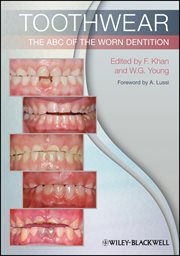 Toothwear : The ABC of the Worn Dentition cover image cdn