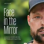 Face in the Mirror : A Surgeon, a Patient, and the Remarkable Story of the First Face Transplant at Mayo Clinic cover image cdn