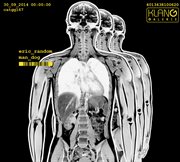 Man Dog cover image cdn