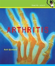 Arthritis cover image cdn