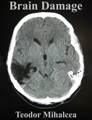 Brain Damage cover image cdn