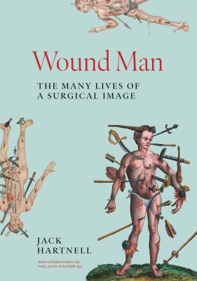 Wound Man : The Many Lives of a Surgical Image cover image cdn